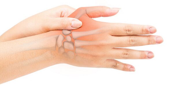 A ligamentite estenosante bloqueia o dedo em uma posição flexionada