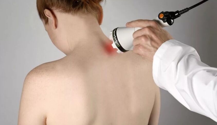 Método fisioterapêutico para tratar a osteocondrose cervical