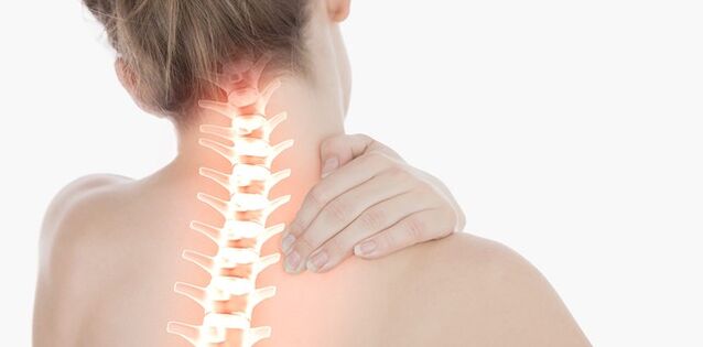 osteocondrose cervical - doença da coluna vertebral